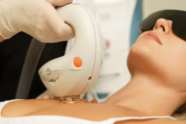 M22 IPL Chest IPL Treatment for Dry Eye