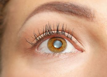 Cataract Surgery resulte