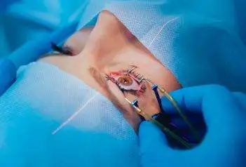 LASIK eye surgery for vision correction in Flushing.