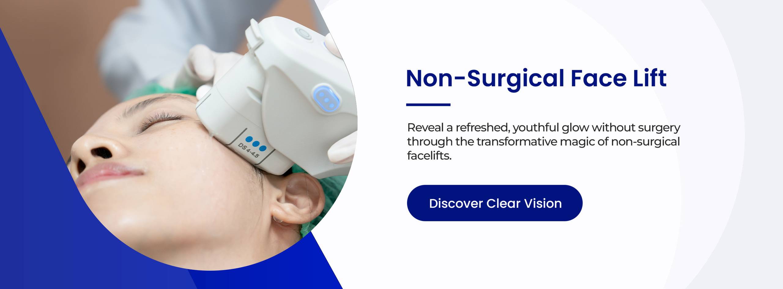 non-surgical-face-lift