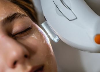IPL for Dry Eye