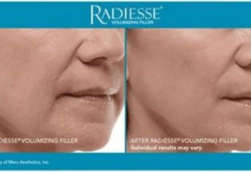 Untitled design 3 Injectables