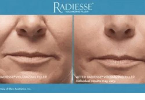 Untitled design 4 Injectables