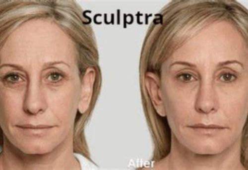 Untitled design 5 Injectables
