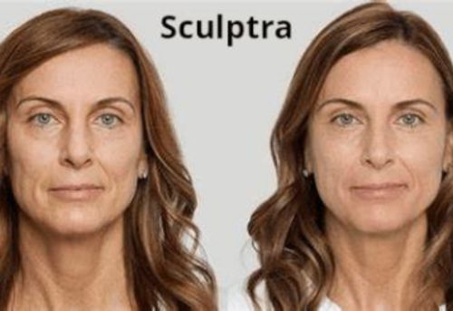 Untitled design 6 Injectables