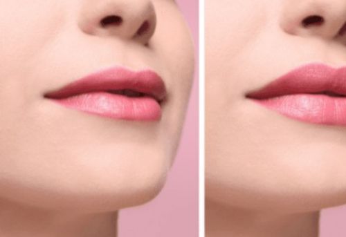Untitled design Injectables