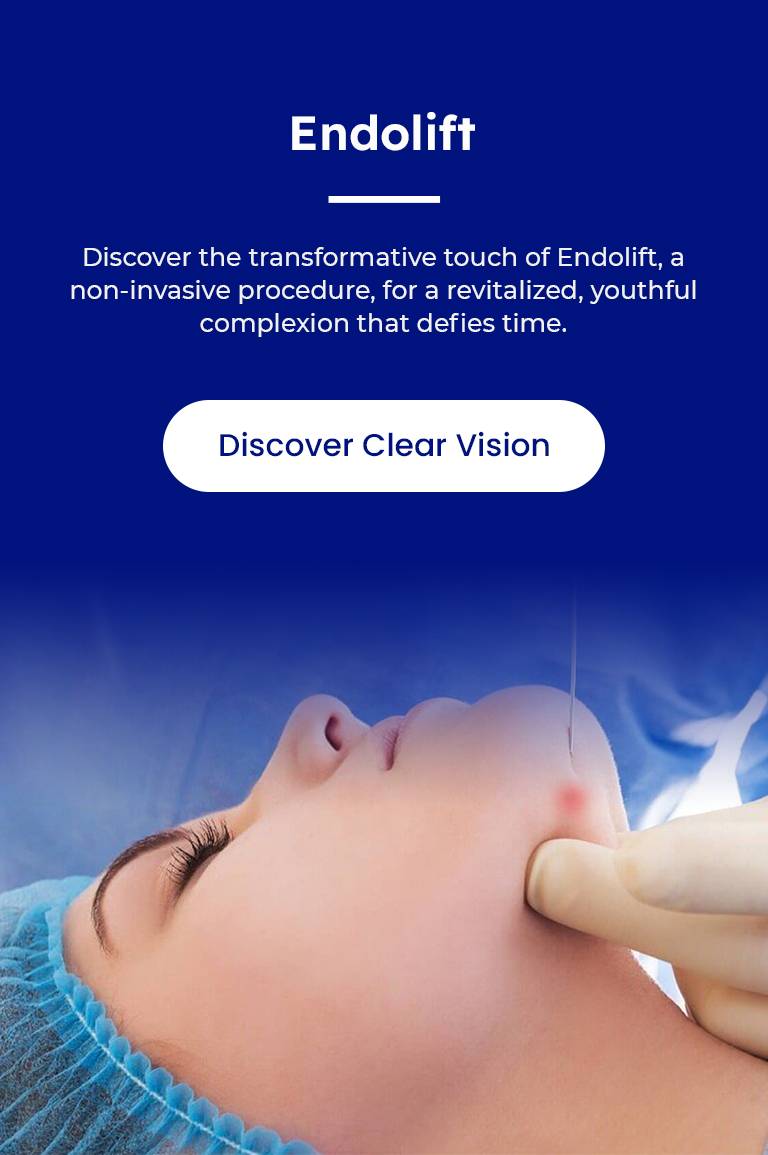 endolift-procedure
