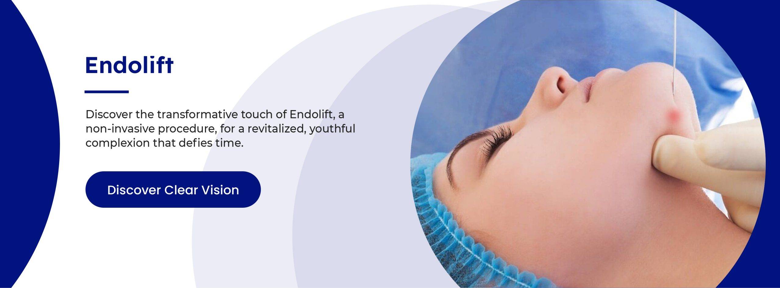 endolift-procedure