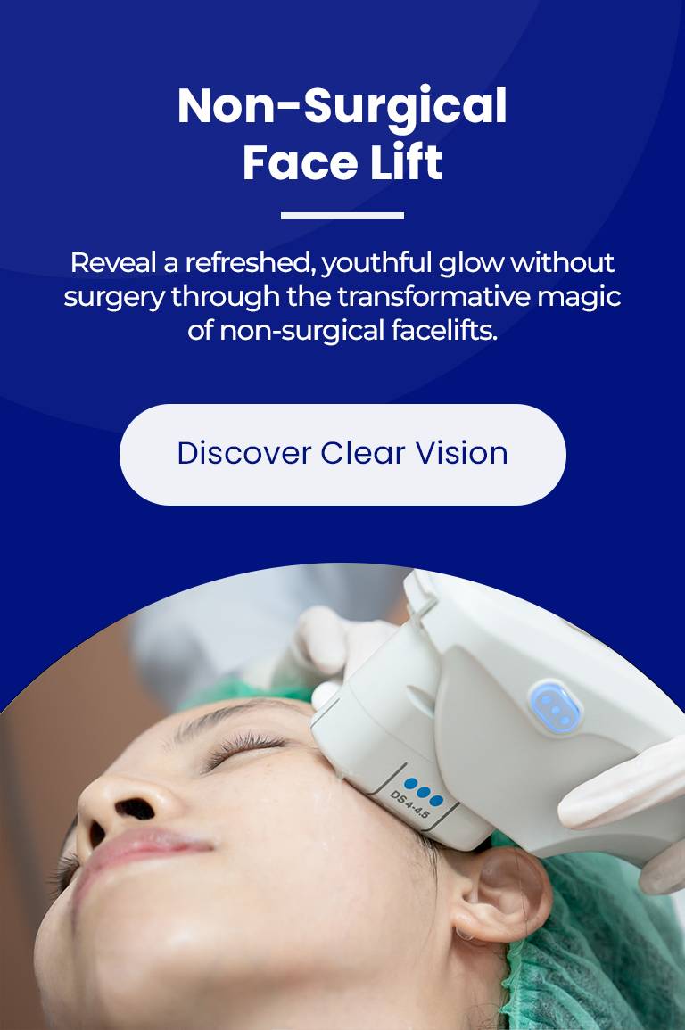 non-surgical-face-lift