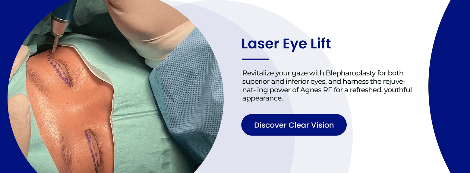 laser-eye-lift