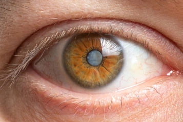 services Cataract Surgery