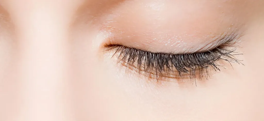Eyelid surgery blepharoplasty