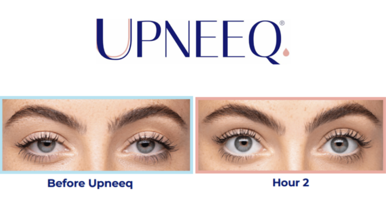 09875667 How does UPNEEQ work