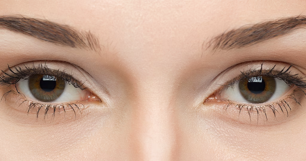4444 jpg What Are Multifocal Intraocular Lenses (IOLs)?
