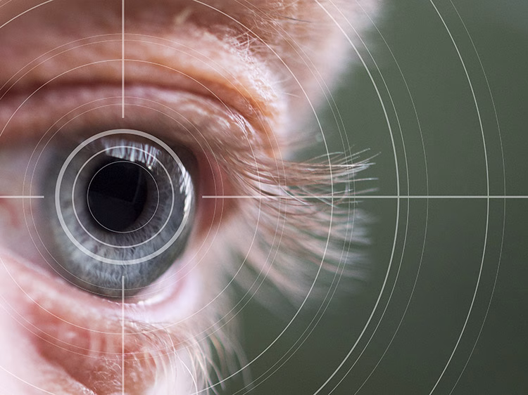 What Are Multifocal Intraocular Lenses (IOLs)?