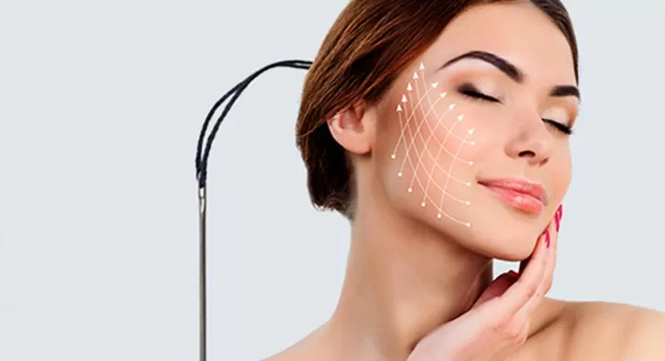 Thread lift by Aesteem Clinic Thread lift without needle