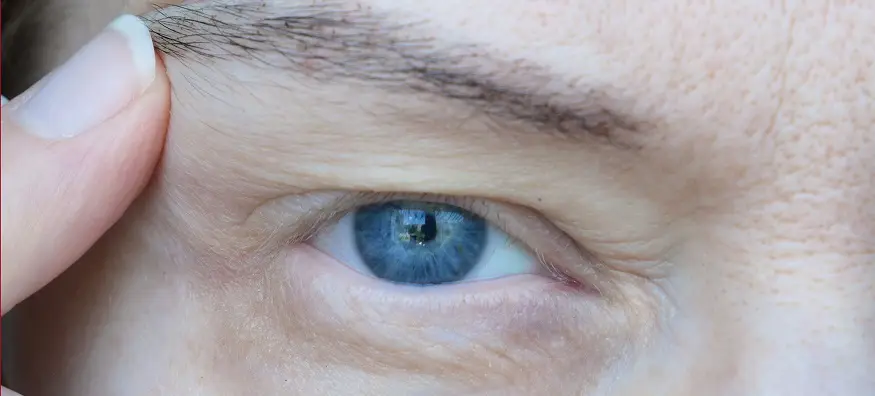 droopy eyelids ptosis Eye Drops for Droopy Eyelids