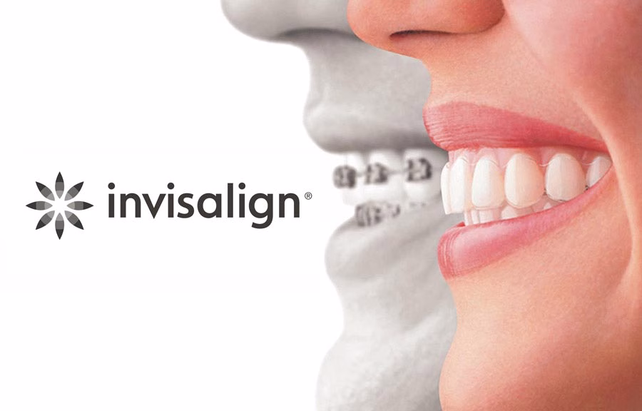 invisalign logo