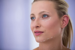 Micro Facelift?