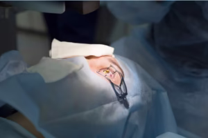 cata2 cataract eye surgery