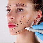 Best Non-Surgical Facelift Treatments