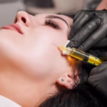 Microneedling Side Effects