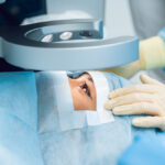 lasik laser vision correction