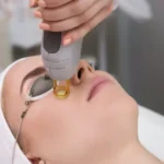 Laser Skin Resurfacing Treatments