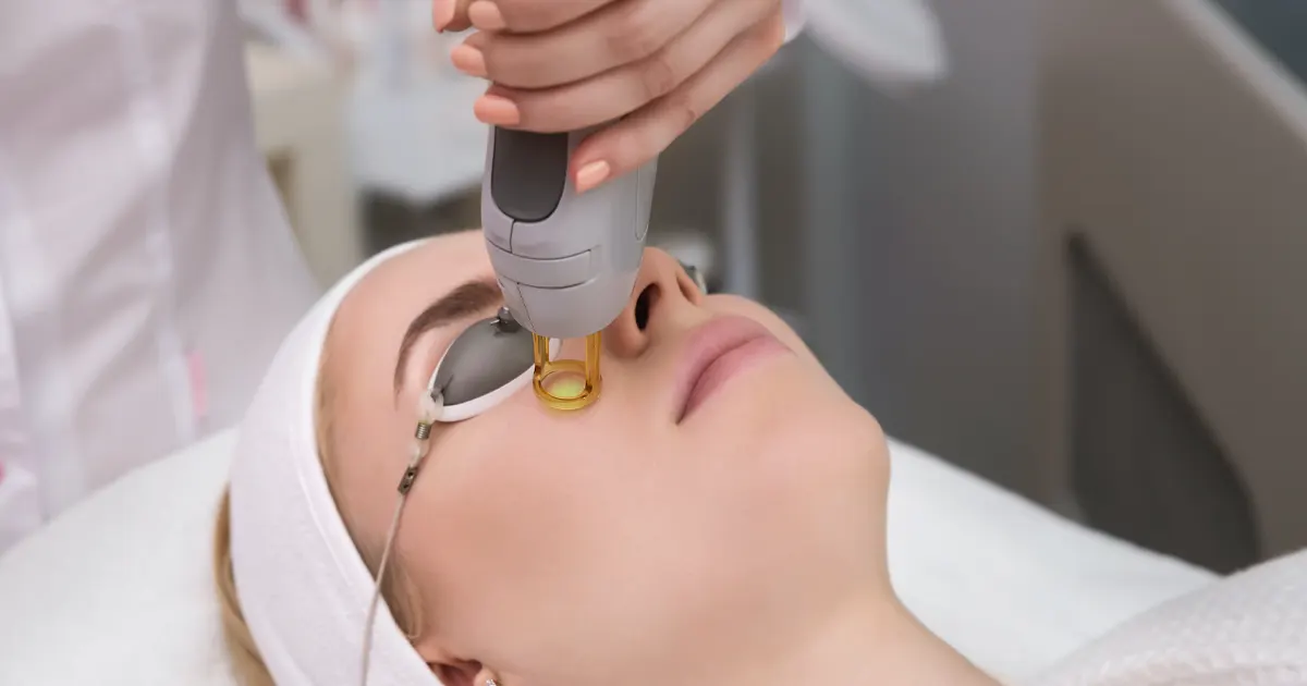 Laser Skin Resurfacing Treatments