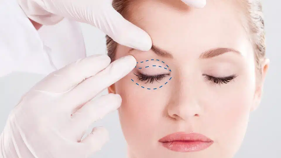Restore your youthful look and improve vision with blepharoplasty in New York. Expert surgeons offer laser eyelid surgery. Book your consultation today!