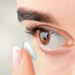 Contact Lens Fittings