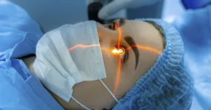 lasik eye surgery recovery