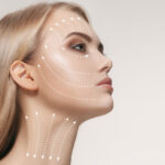 non surgical facelifts