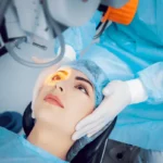 Laser Cataract Surgery Ny