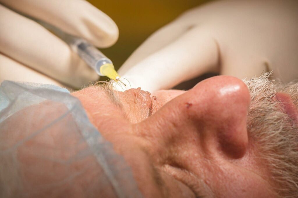 Best Treatment for Diabetic Retinopathy