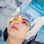 laser vision correction types
