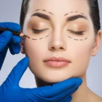 Eye Lift Laser Surgery at Leevision