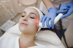 Laser Skin Resurfacing in New York