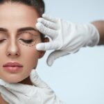 Eyelid Lift Surgery
