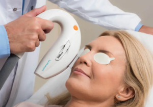 IPL Treatment for Dry Eye At Leevision