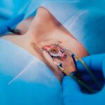 best lasik eye surgery near me