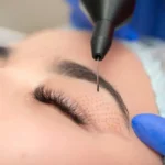 Laser Blepharoplasty in Flushing NY | Leevision