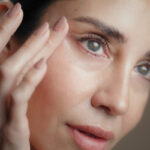 Upper Blepharoplasty NYC