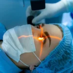 Cataracts Treatment Laser | Leevision Eye Care