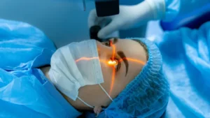 Cataracts Treatment Laser | Leevision Eye Care