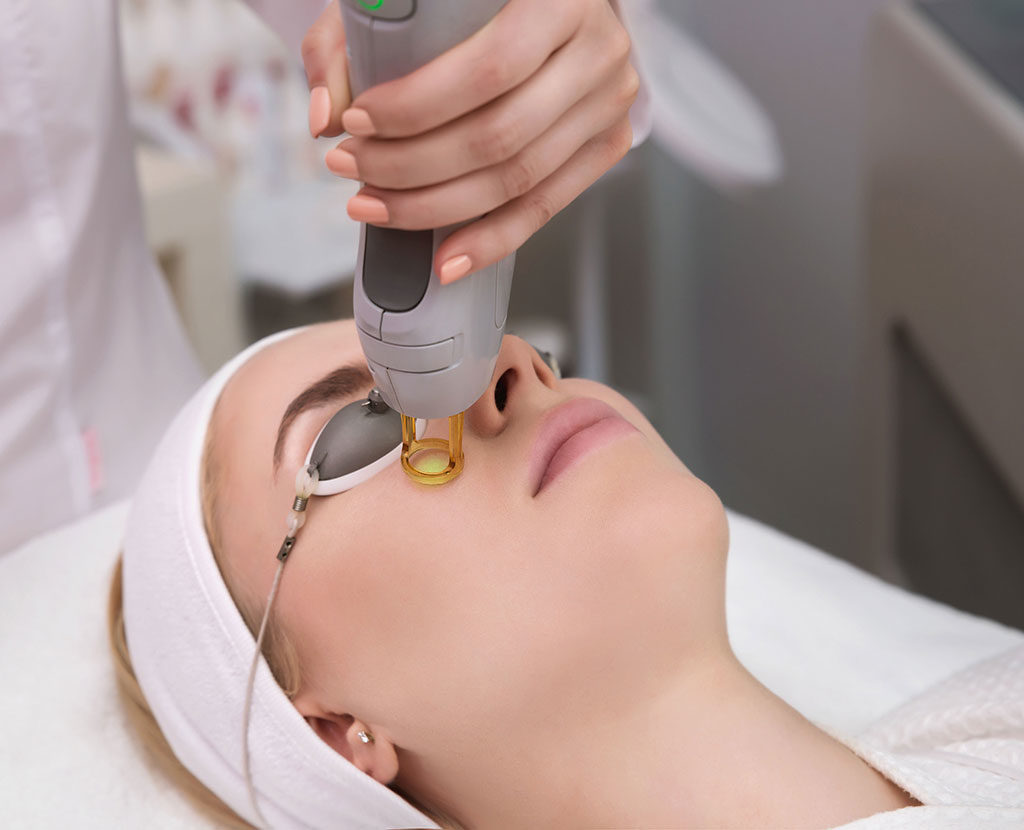 Laser Skin Resurfacing Treatment for skin