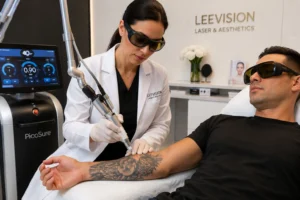 Tattoo laser removal near me treatment using PicoSure laser technology in NYC clinic