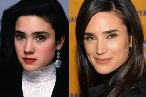celebrities with upper treatment blepharoplasty celebrity upper blepharoplasty before and after