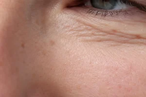 ChatGPT Image Jun 10 2026 01 27 51 AM close up under eye wrinkles natural skin texture