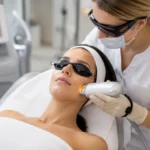 Best laser treatment for skin tightening performed by a cosmetic specialist